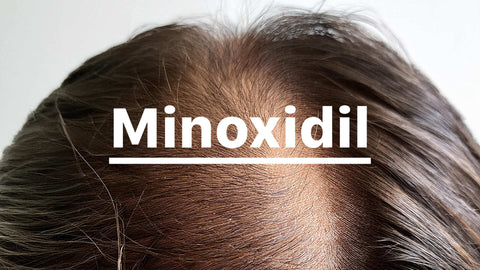 ¿Qué tiene de malo el minoxidil? Descubre cuándo funciona y cuándo no