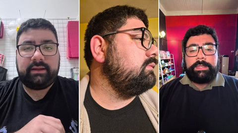 Bastián, cliente de ILEV Routine, cuenta su experiencia con la caspa