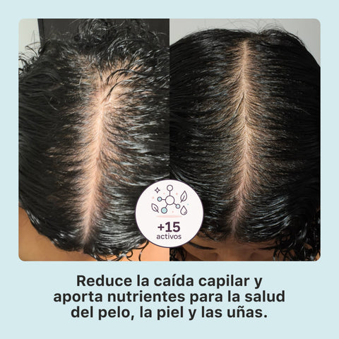 DUO ANTIcaída y densidad capilar TÓNICO + BOMBA NUTRICIONAL | 30 días