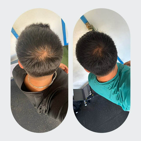 DUO ANTIcaída CRECIMIENTO INTENSIVO Bomba + Tónico