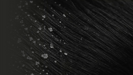 SHAMPOO ANTICASPA VIAJERO