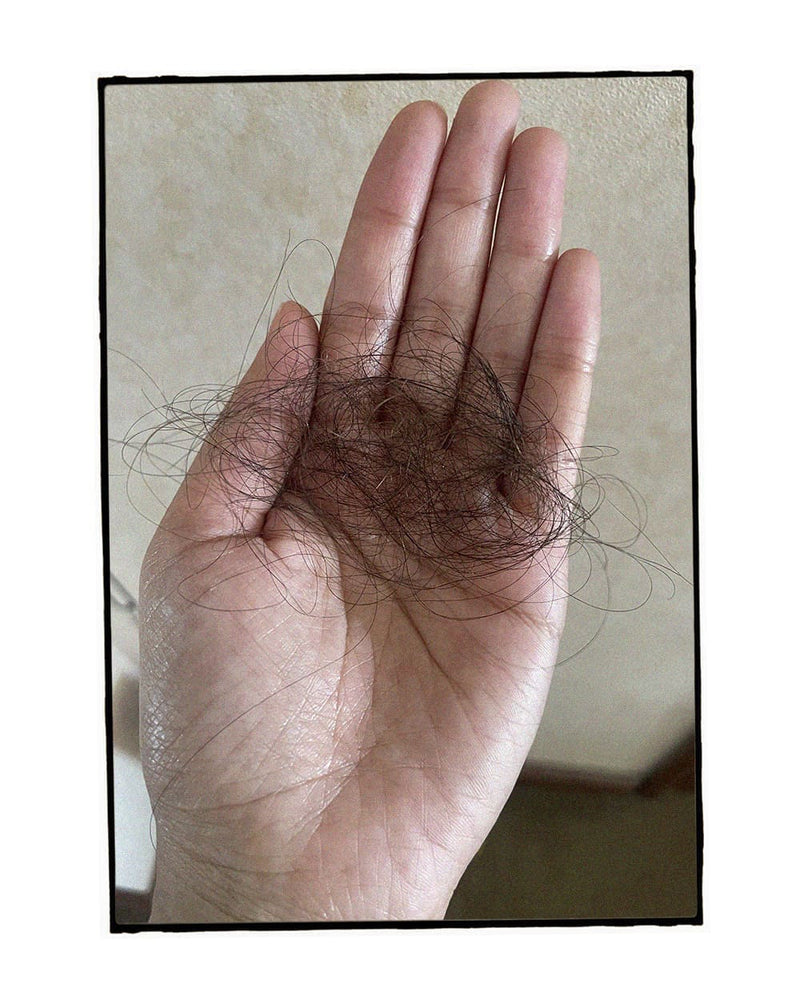 Prevención
