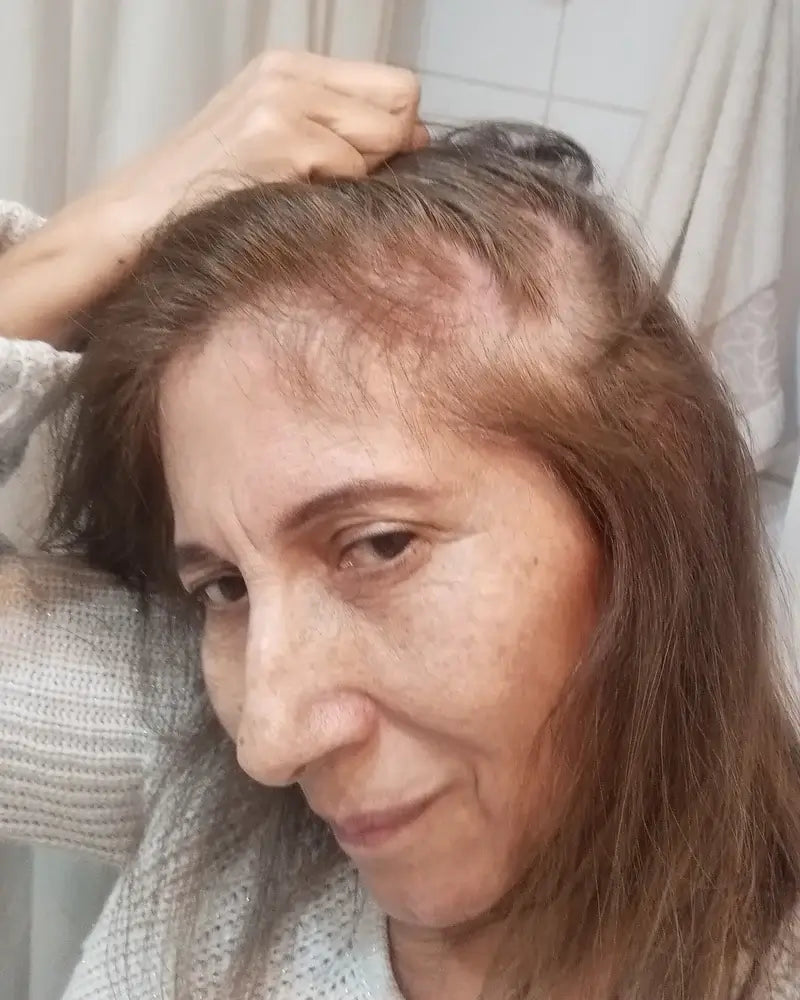 Lucía antes de empezar la rutina anticaída de ILEV Routine
